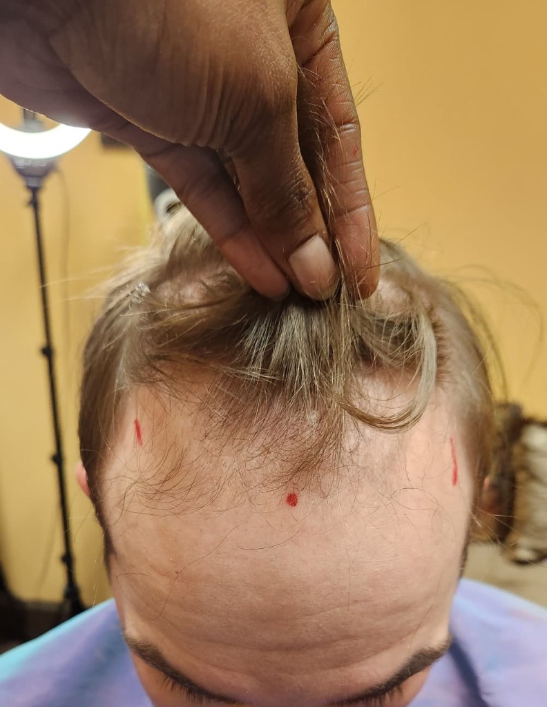 Scalp & Hair Health Treatments at A Better You Hair Studio, Chattanooga TN