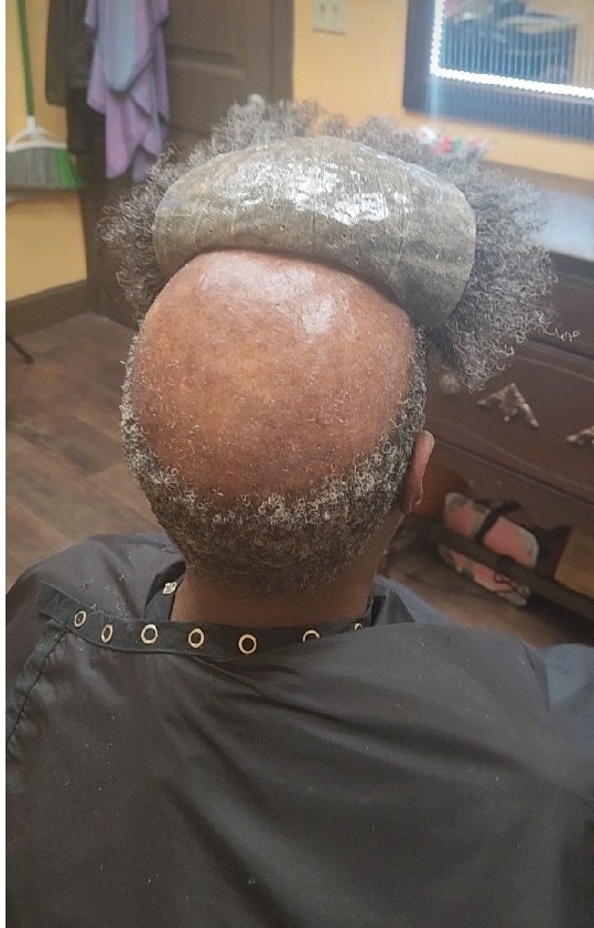 Non-Surgical Hair Replacement in Chattanooga, TN: The Complete Beginner’s Guide